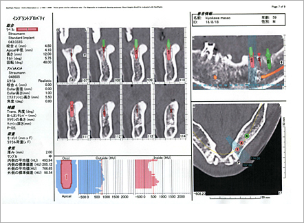 精密CT診断画像2