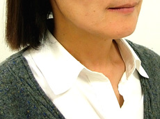 インプラント患者SU様写真